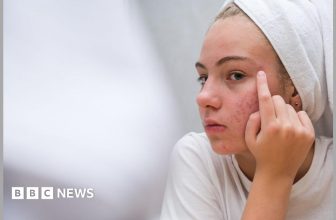 The simple skincare routine for teens that actually works – and five expert tips