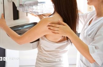 County Durham breast cancer failure bosses to review 4,500 more cases
