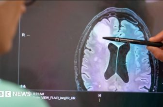How a rapid new test is helping brain tumour patients